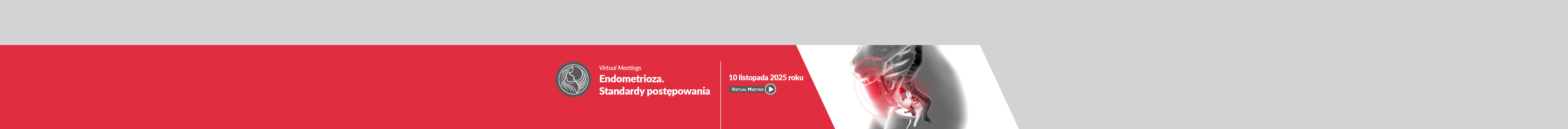 Endometrioza 2025
